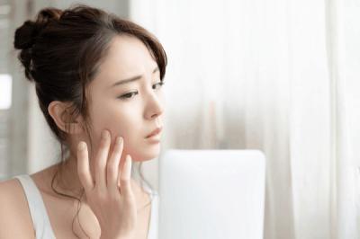 "Bùng phát” mụn sau mùa giãn cách - Đâu là giải pháp phục hồi da hiệu quả?