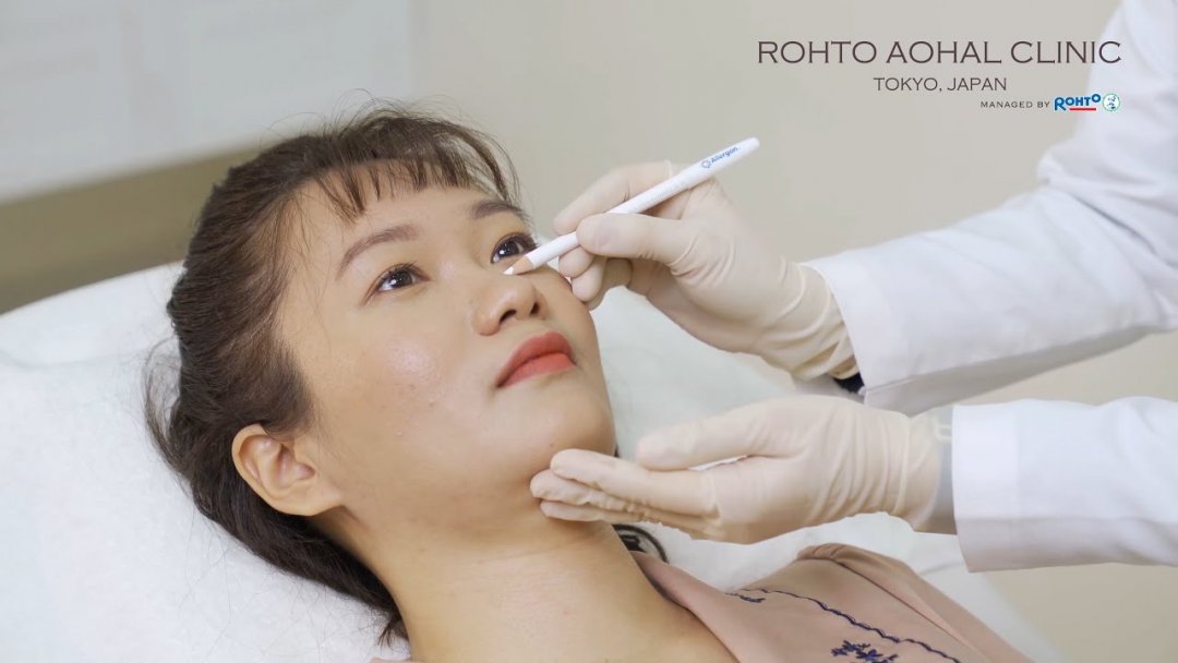 tiêm botox tại Rohto Aohal Clinic