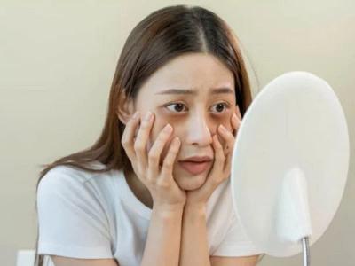 Quầng thâm mắt có tự hết không? Lưu ngay cách trị thâm mắt hiệu quả chỉ sau một đêm