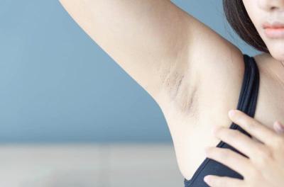 Top 5 cách trị thâm nách đơn giản giúp da sáng đều tự nhiên