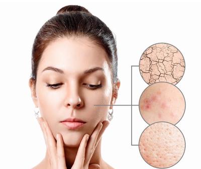 Phục hồi da là gì? Khi nào làn da cần được phục hồi đúng cách?