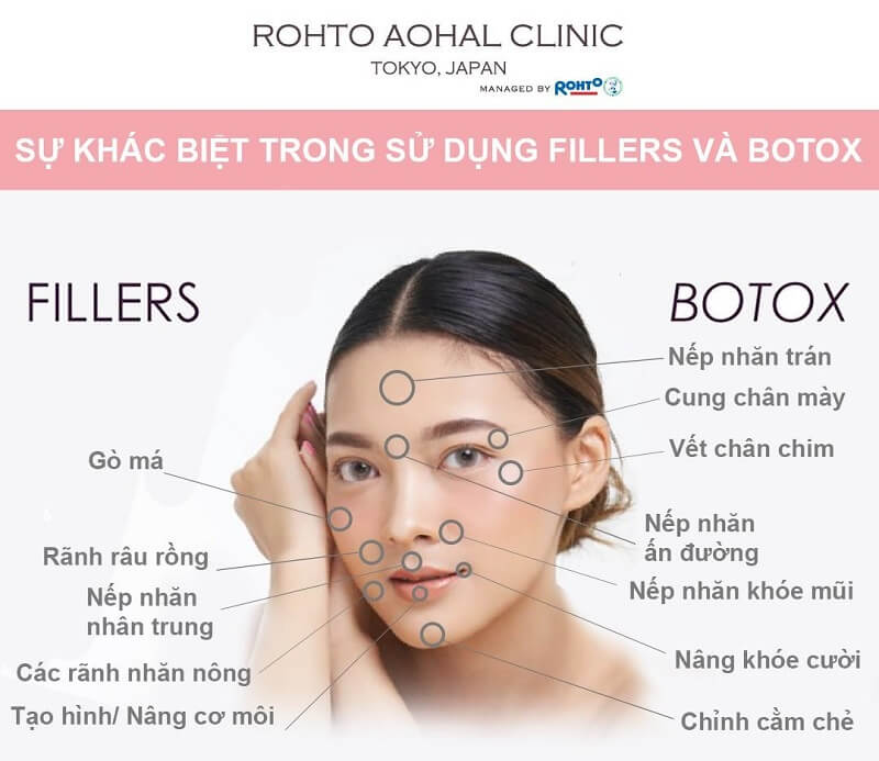 phuong-phap-tre-hoa-da-mat-dung-botox-va-filler