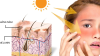 EFFECTIVELY WAY OF PIGMENTATION REMOVAL FROM DEEP WITHIN ACCORDING TO EXPERT ADVICE