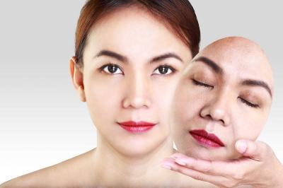 Có nên nâng cơ xóa nhăn ở các Viện thẩm mỹ hay không?