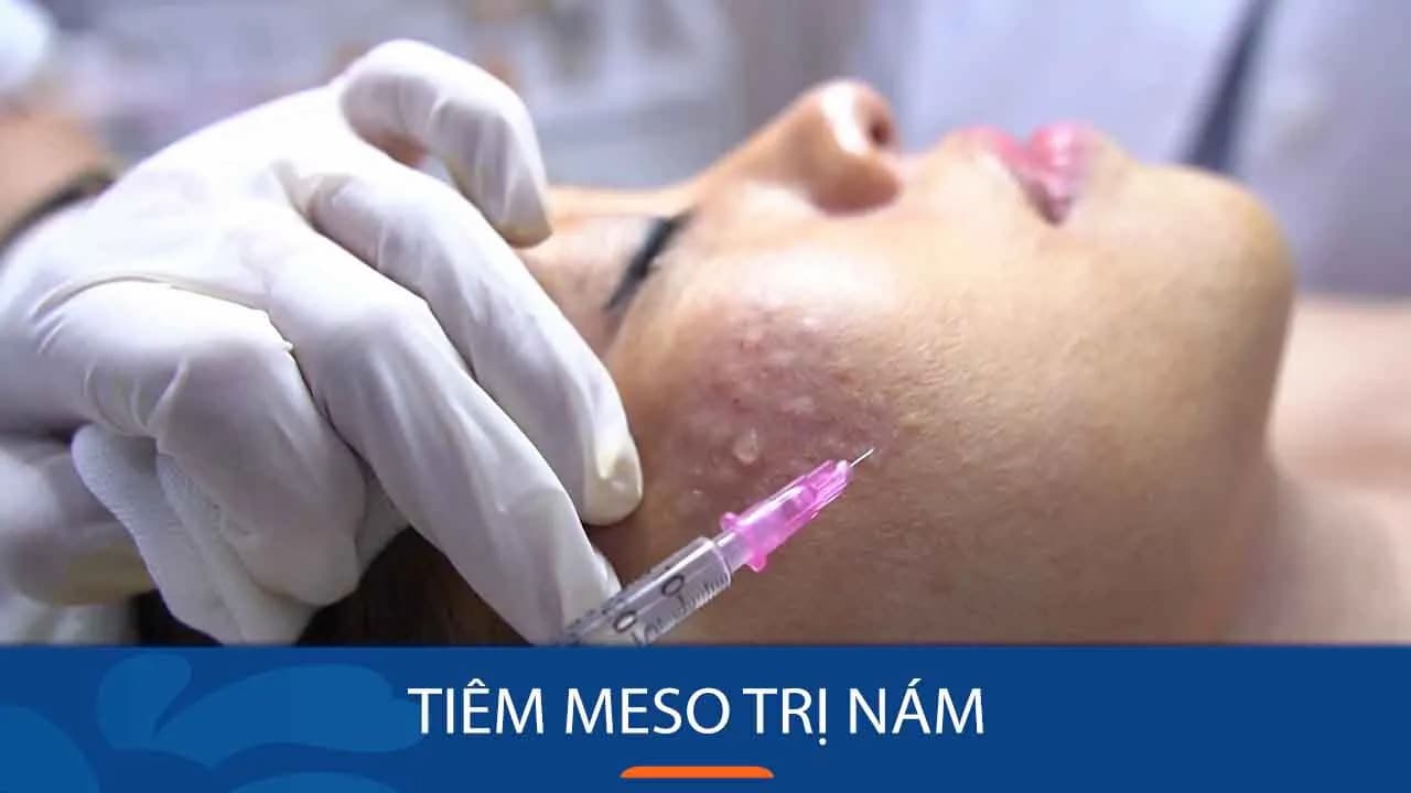 tiem-meso-tri-nam-7