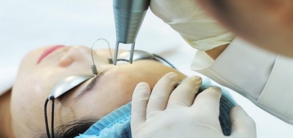 Cách chăm sóc da bị thâm nám đúng cách tại nhà sau khi trị liệu bằng laser