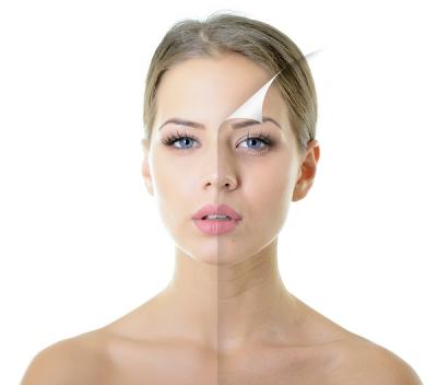 LASER TRẺ HOÁ DA LÀ GÌ? CÓ NÊN TRẺ HÓA DA BẰNG LASER KHÔNG?