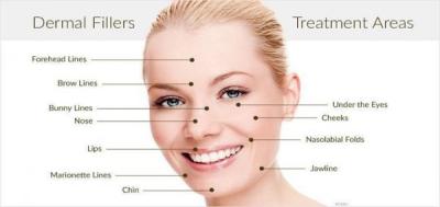 How long does Fillers and Botox effect last?