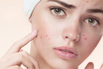 Các bước skincare cho da mụn ngày và đêm 