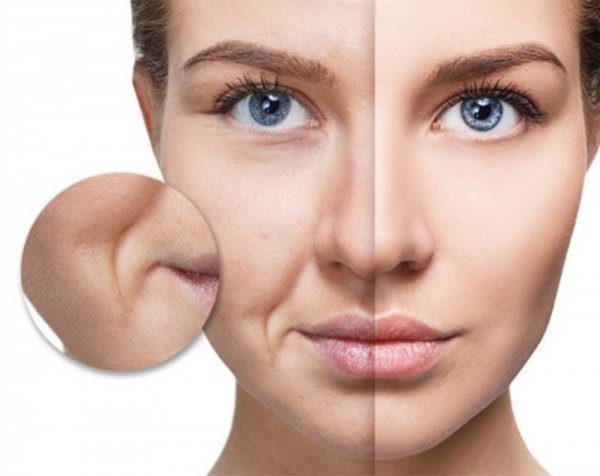 Lão hóa là nguyên nhân khiến những nếp nhăn ở khóe miệng xuất hiện