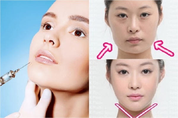 When using Botox for aesthetics, diet programs and post-injection care are very important