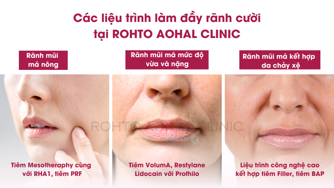 WEB_Tiem_ranh_mYi_ma_2