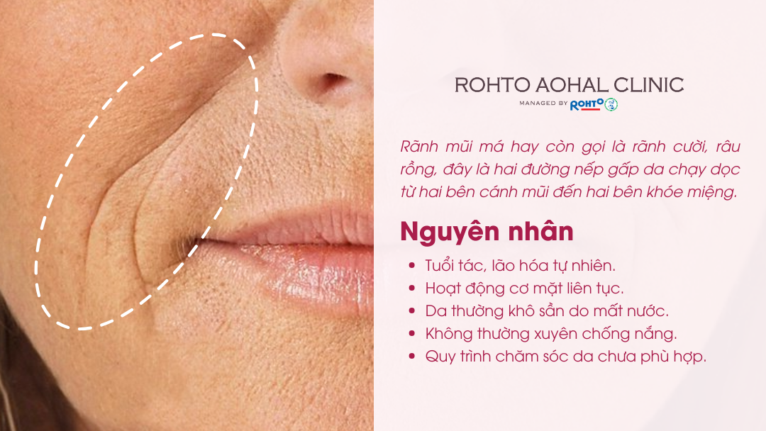 WEB_Tiem_ranh_mYi_ma_3