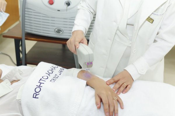 Triệt lông nách công nghệ ánh sáng BBL