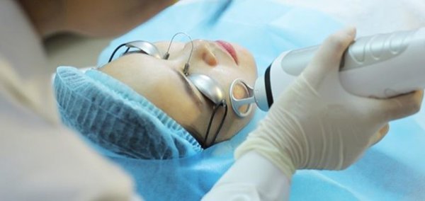医師がレーザーでニキビ痕の治療をする様子