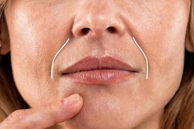 Các phương pháp xoá bỏ đường râu rồng trên mặt không xâm lấn hiệu quả