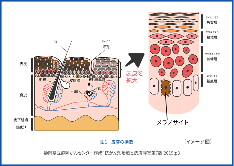 ニキビ跡 色素沈着 改善 炎症後色素沈着の仕組み