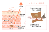 ニキビ跡の色素沈着改善｜Rohto AOHAL Clinicの治療とケア方法