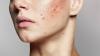 Cách Bổ Sung Collagen Cho Da Mặt Hiệu Quả Giúp Da Căng Mịn, Trẻ Lâu 