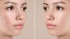 Cách Bổ Sung Collagen Cho Da Mặt Hiệu Quả Giúp Da Căng Mịn, Trẻ Lâu 