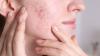 Cách Bổ Sung Collagen Cho Da Mặt Hiệu Quả Giúp Da Căng Mịn, Trẻ Lâu 