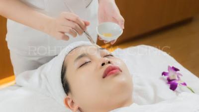 BBL Hay Peel Da: Phương Pháp Nào Hiệu Quả Hơn Để Trị Mụn Dứt Điểm?