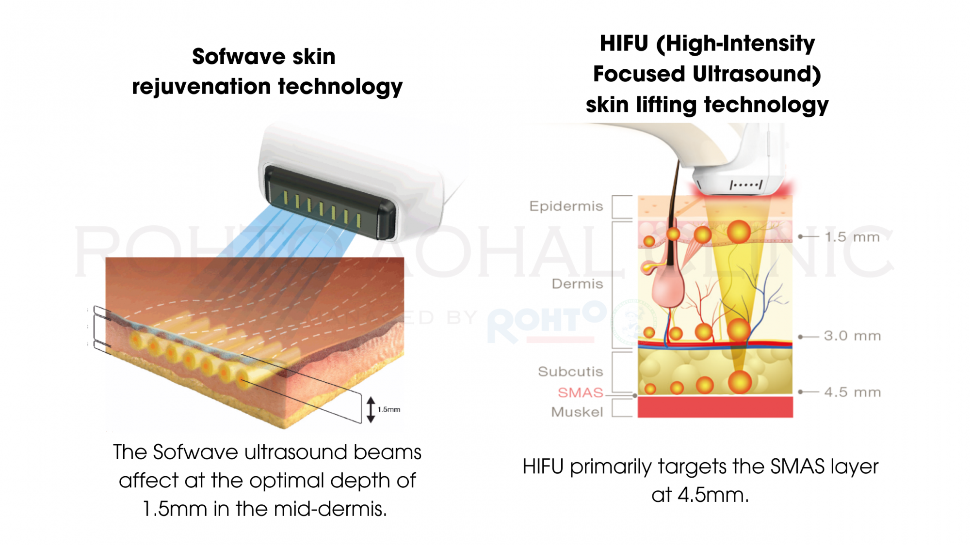 1-sofwave-eng