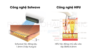 SO SÁNH CÔNG NGHỆ TRẺ HÓA DA SOFWAVE VÀ HIFU