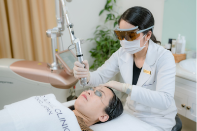 Trị nám bằng laser – Bí quyết lấy lại làn da sáng mịn