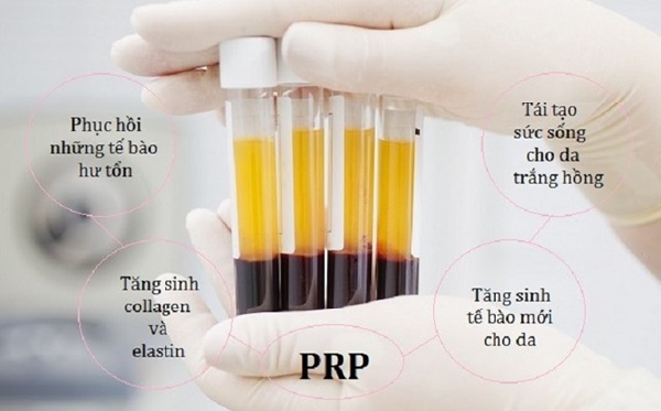 prp-co-tot-khong