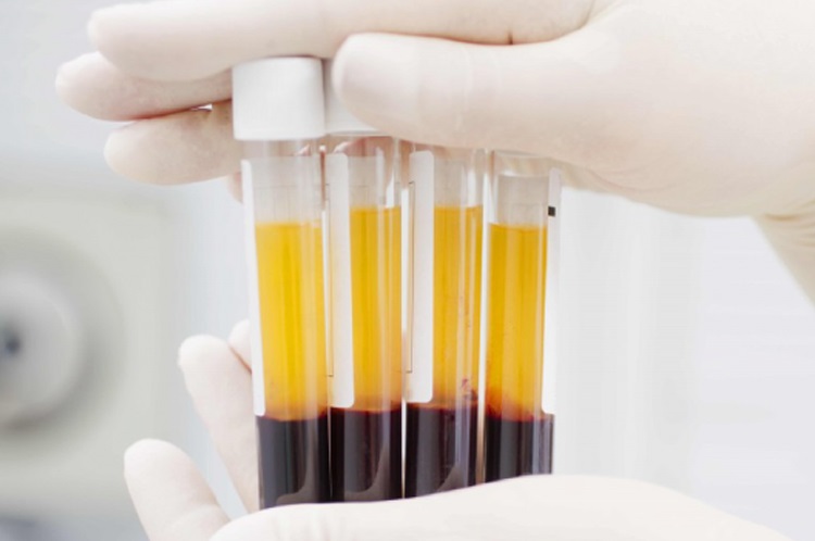 prp-la-gi_1