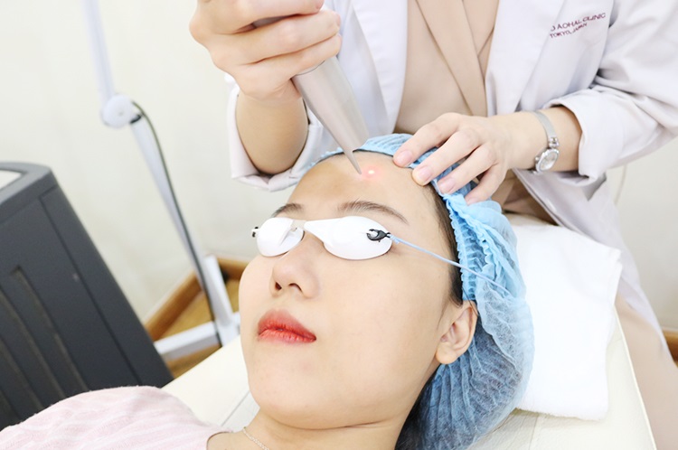 Công nghệ laser Q-switched