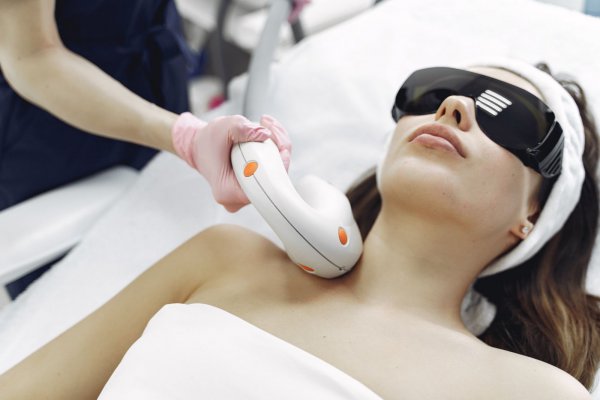 Medical-Laser-Hair-Removal-3