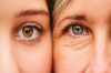 REMOVE EYE WRINKLES ACCORDING TO EXPERT ADVICE
