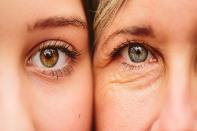 REMOVE EYE WRINKLES ACCORDING TO EXPERT ADVICE