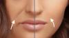 Top 5 tips on how to get rid of smile lines effectively