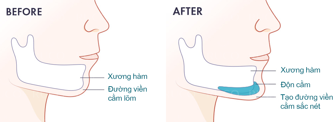 don_cam_vline_sun_hoa_ky_chinh_hang1