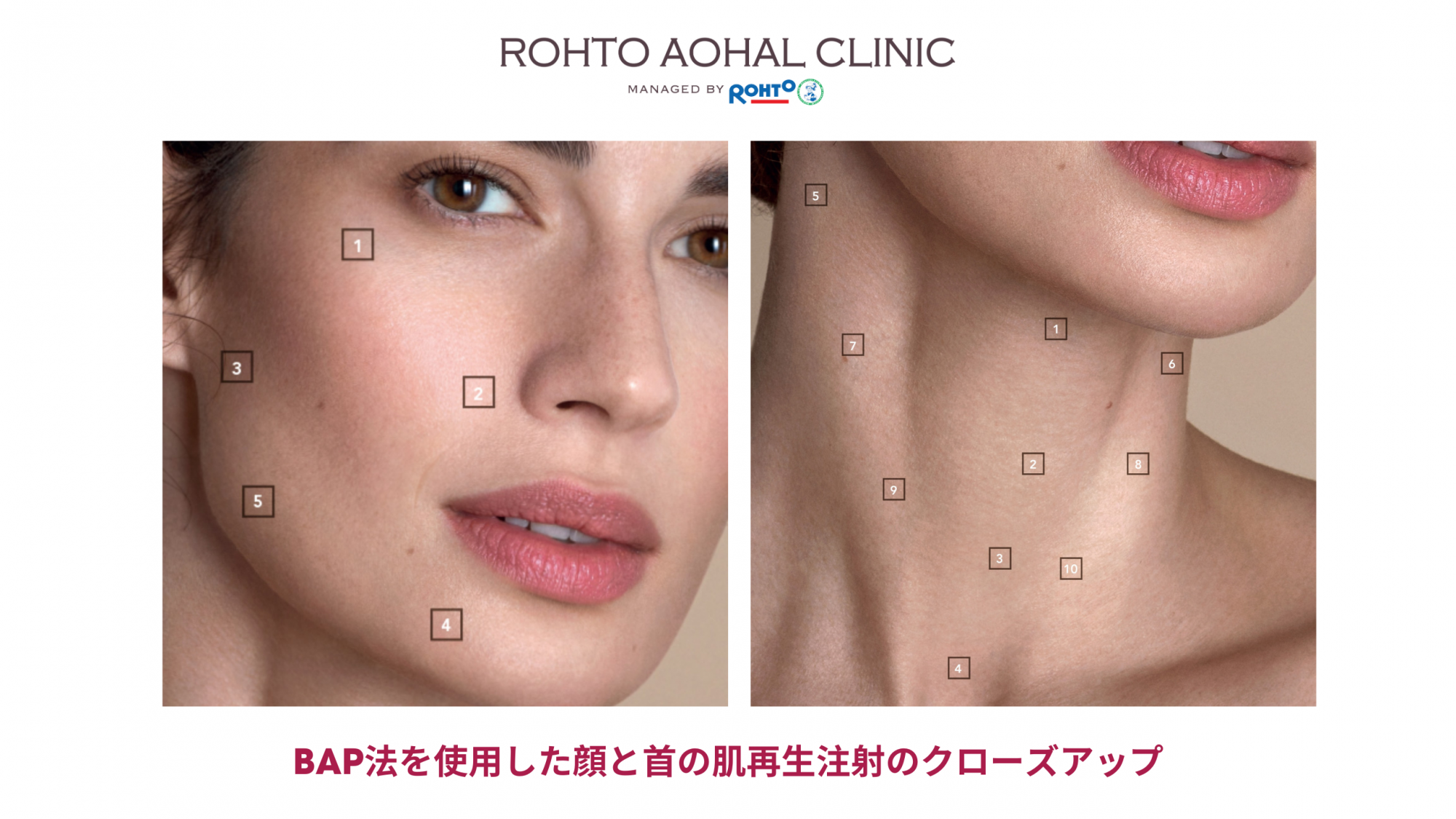 bap