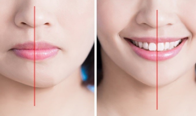 Khám phá ngay 5 cách cải thiện mặt lệch hiệu quả có thể bạn chưa biết