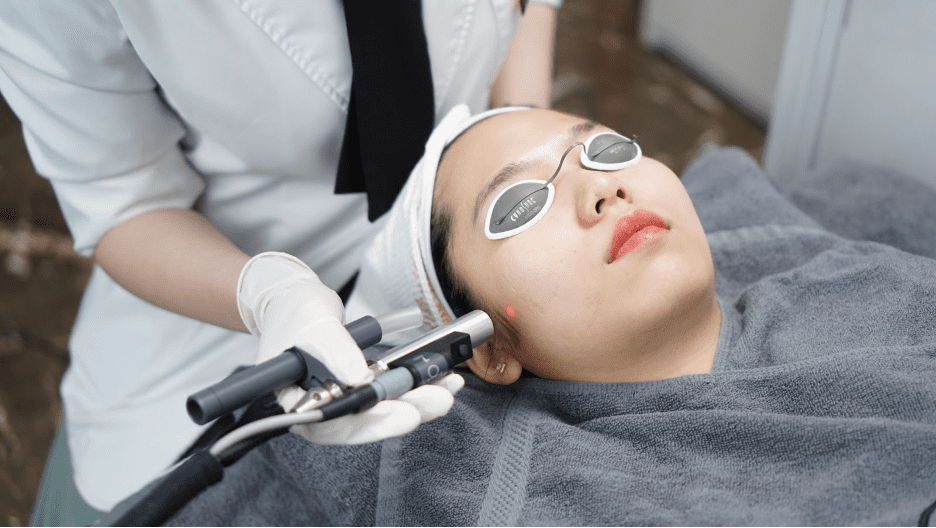 Thuc-hien-ban-laser-tri-mun