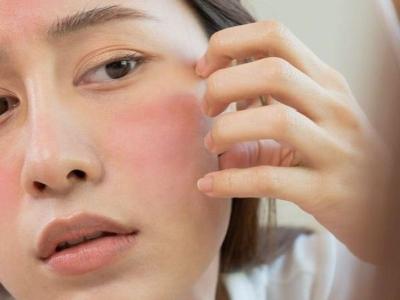 Nắm rõ các nguyên tắc vàng khi chăm sóc da mùa đông để da luôn mềm mịn, không khô ráp