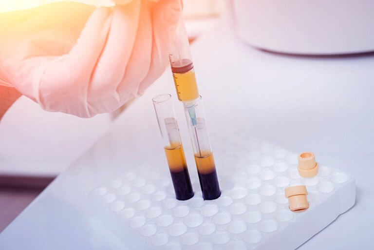 Chiết tách huyết tương giàu tiểu cầu PRP