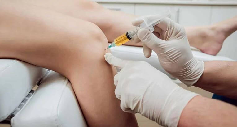 Ứng dụng PRP trong điều trị xương khớp