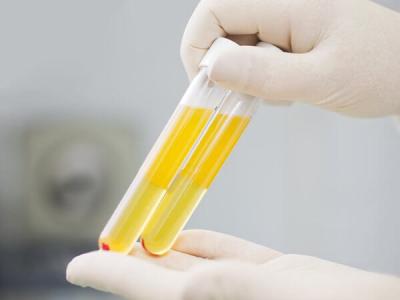 Tiêm huyết tương là gì? Ứng dụng của PRP tiêm huyết tương giàu tiểu cầu tự thân