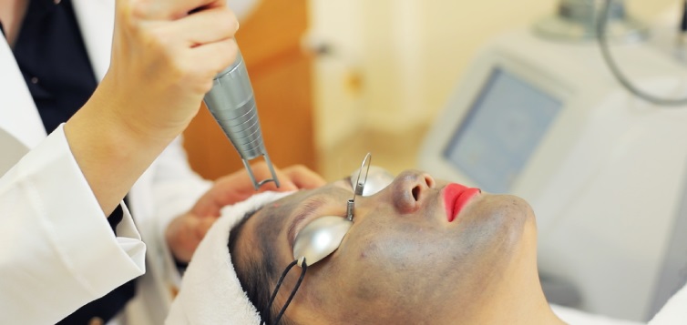 diamond-peel-3