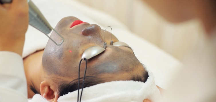 diamond-peel-4