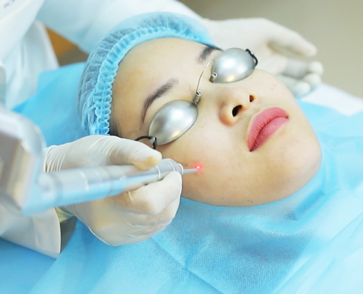 trị-mụn-thịt-mụn-cóc-mụn-gạo-1
