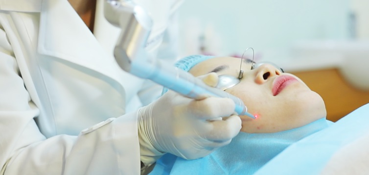 Bác sĩ đang trị mụn bằng laser tại phòng khám